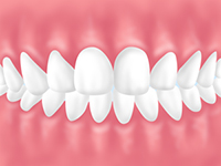 咬み合わせ重視の治療を行っています