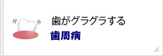 歯がグラグラする歯周病