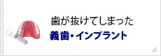 歯が抜けてしまった義歯・インプラント